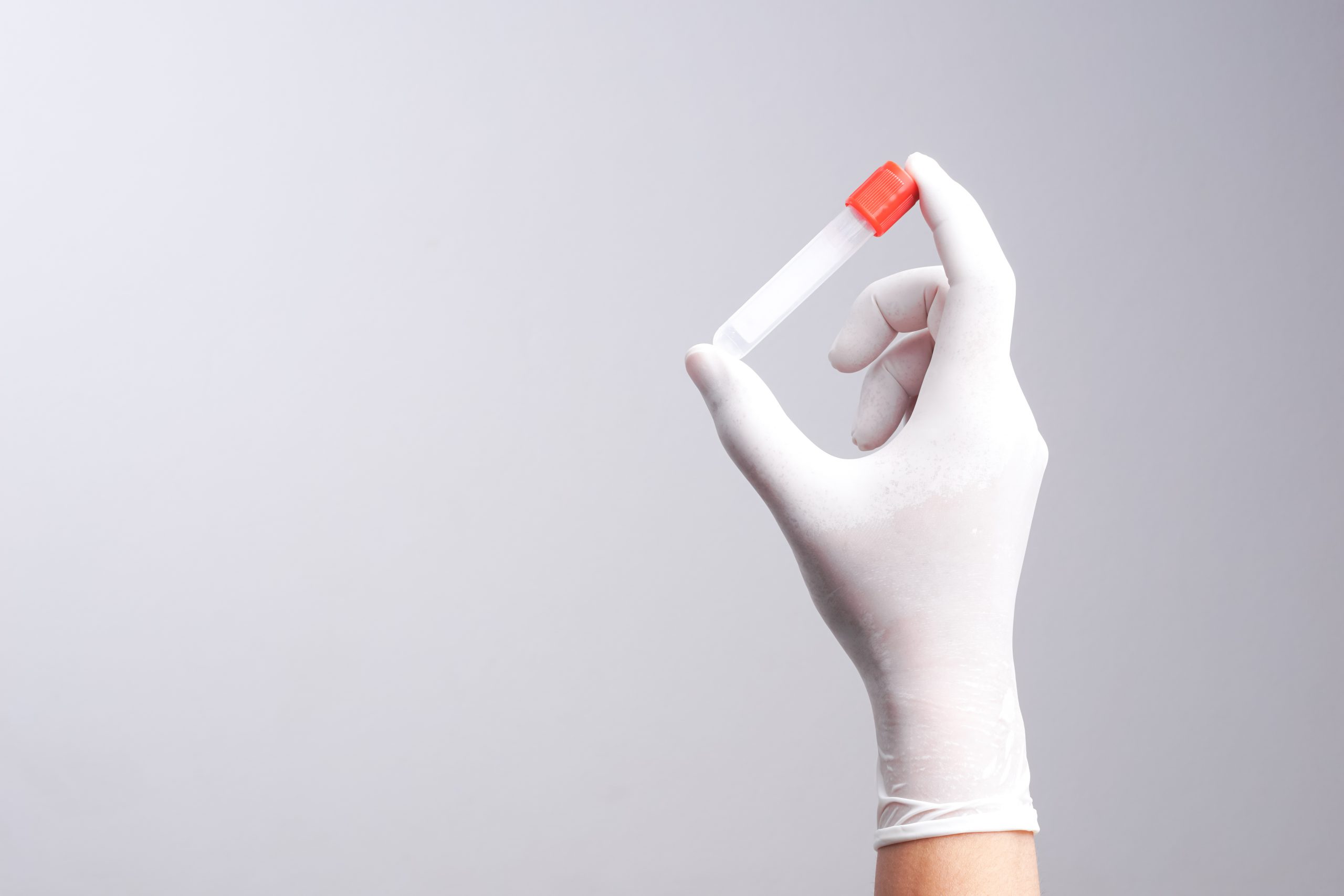 Hand with latex glove holding empty test tube. MEDIjobs